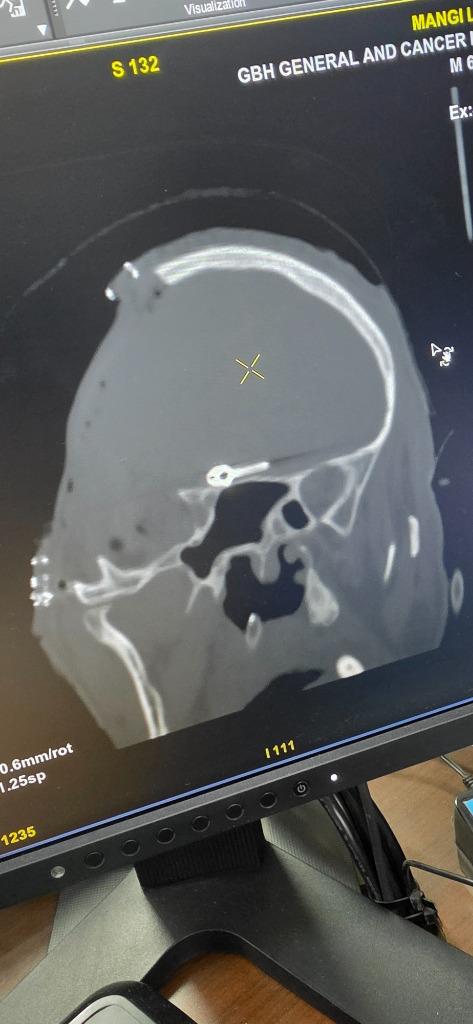 CT Scan – Cranial Imaging